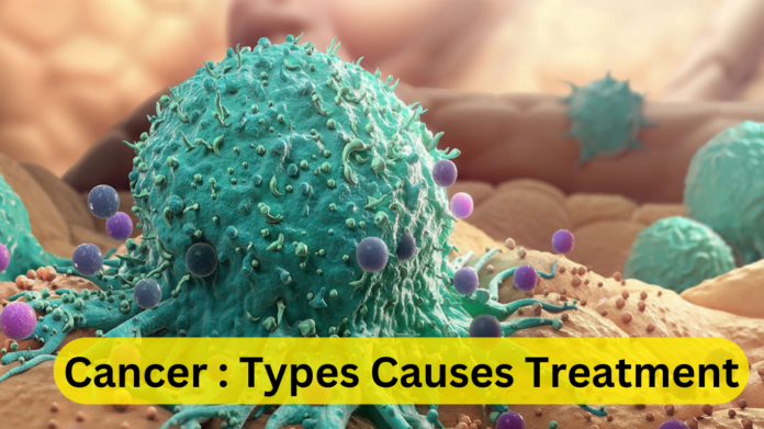 Cancer : Types Causes Treatment