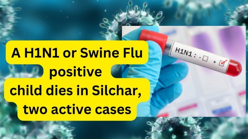 Swine Flu