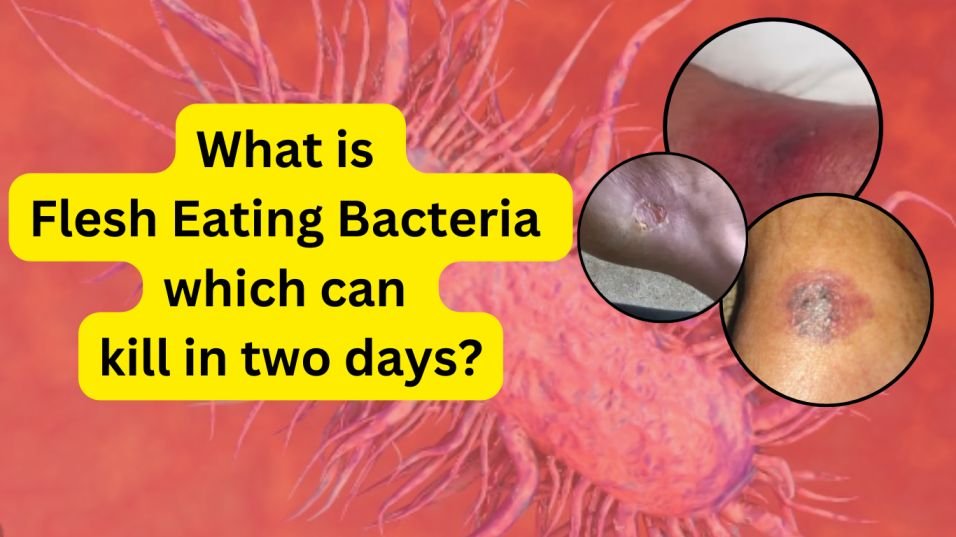 Flesh Eating Bacteria