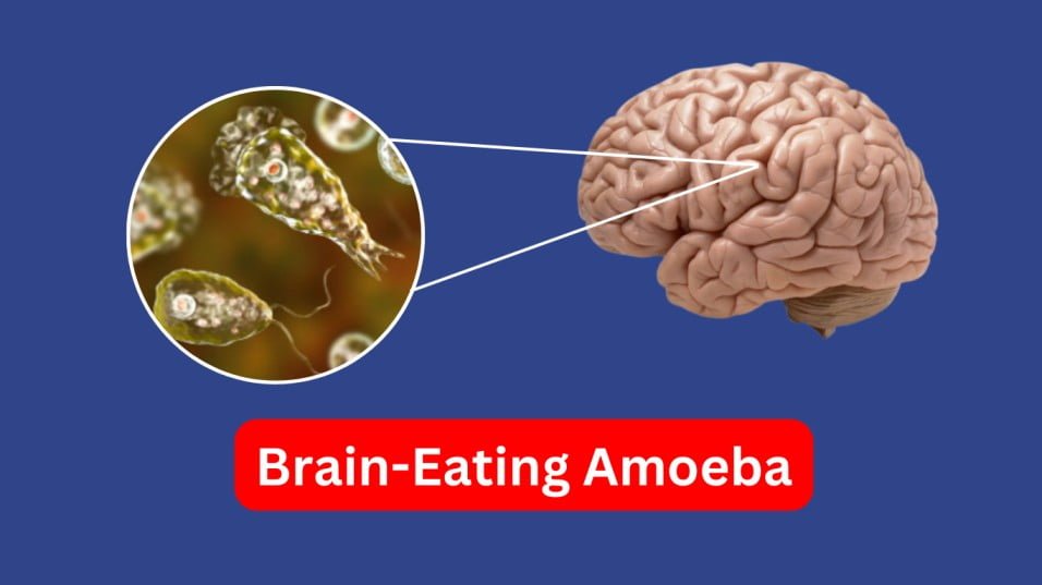Brain-Eating Amoeba