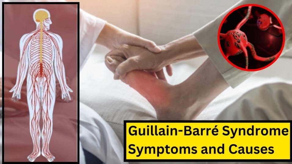 Guillain-Barré Syndrome