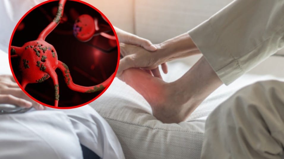 Assam Guillain-Barre Syndrome